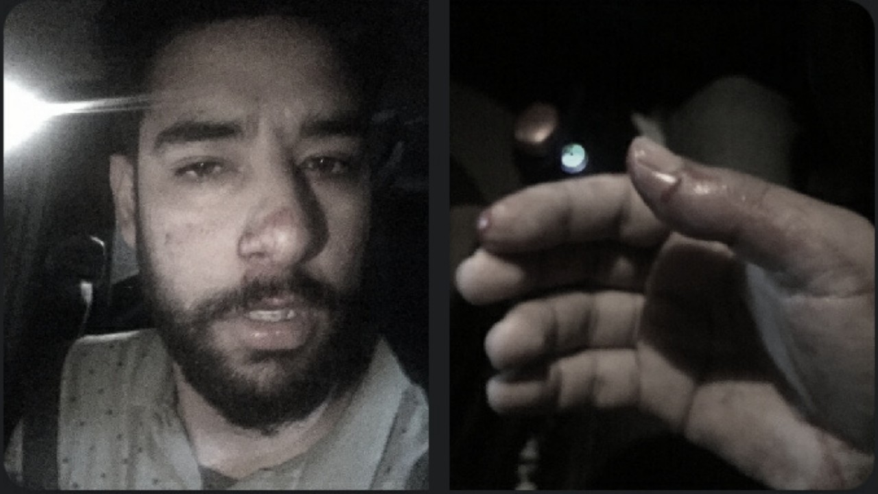 Journalist Aakash Hassan allegedly beaten by cops on NH way in Anantnag Journalist Aakash Hassan allegedly beaten by cops on NH way in Anantnag