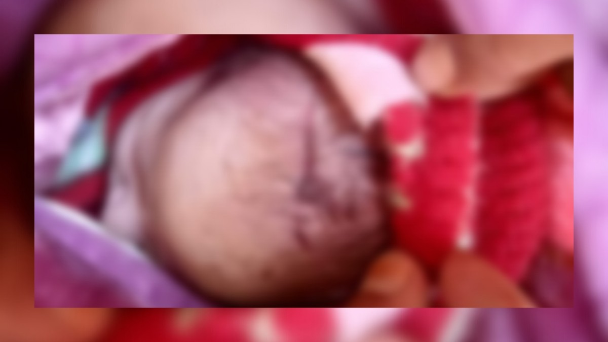 Deep cut on baby’s head at the time of delivery, family accuses doctor of killing new-born baby at SDH Tangdhar