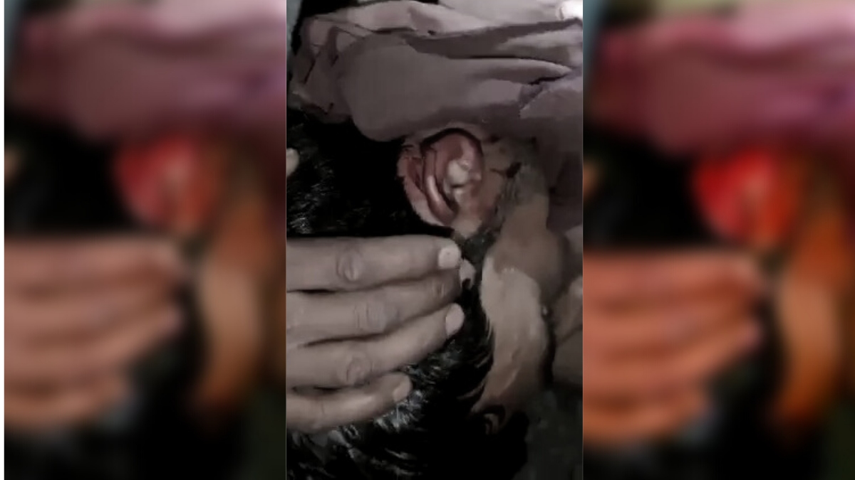 Employees at toll post Banihal allegedly cut ear of Driver, DC assures action