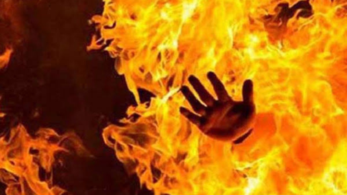 Two months after receiving burn injuries, Sgr woman dies at SMHS hospital