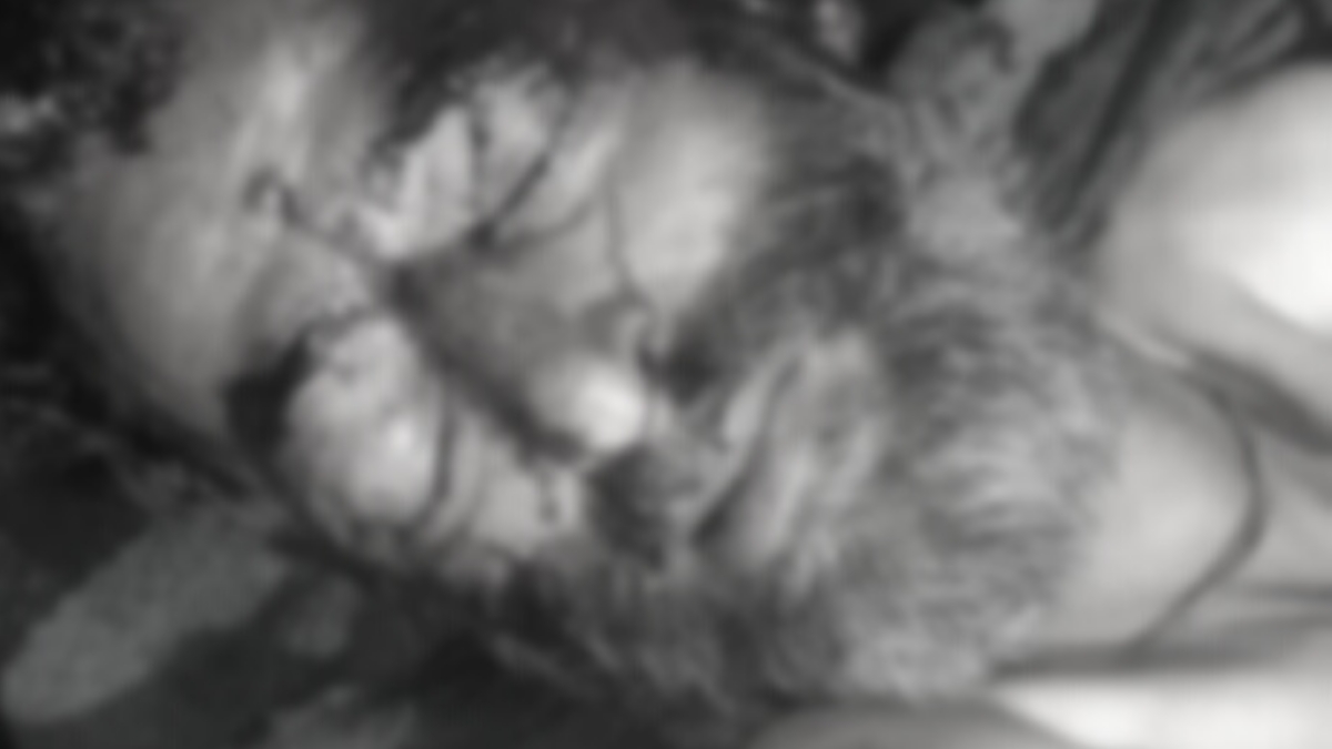 Kulgam attack: Injured civilian succumbs at SKIMS Kulgam attack: Injured civilian succumbs at SKIMS