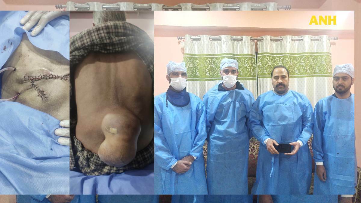 After 16 years, Anantnag man able to sleep properly, courtesy AB-PMJAY scheme