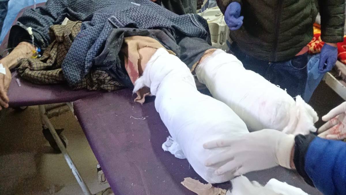 Anantnag man who attempted suicide by jumping in front of moving train succumbs Man loses both limbs in ‘suicide bid’ in Anantnag