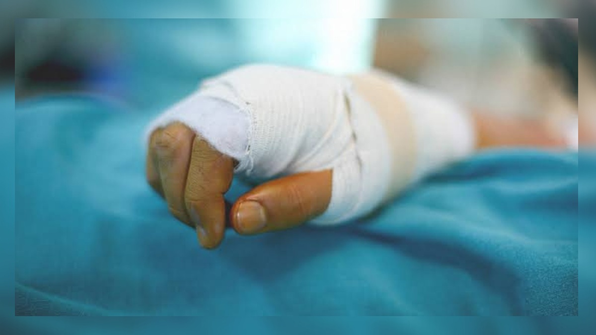 Girl critically injured in downtown road accident Woman suffers burn injuries in kerosene stove blast in Bandipora