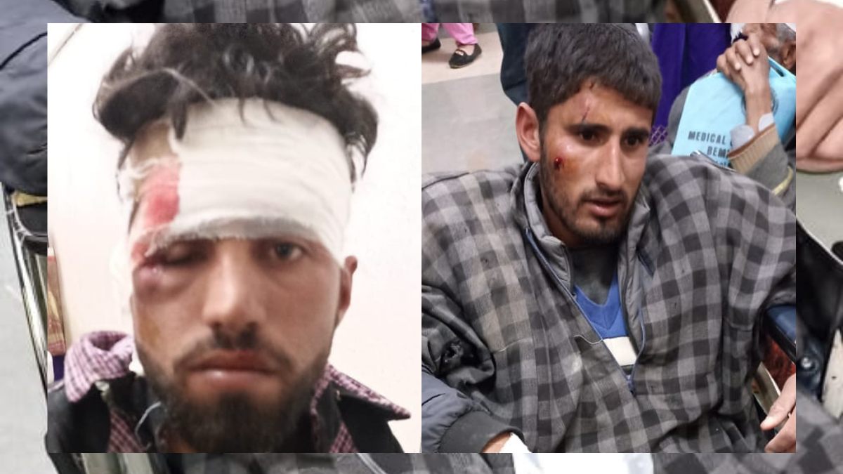 09 injured as vehicle turns turtle in Ganderbal