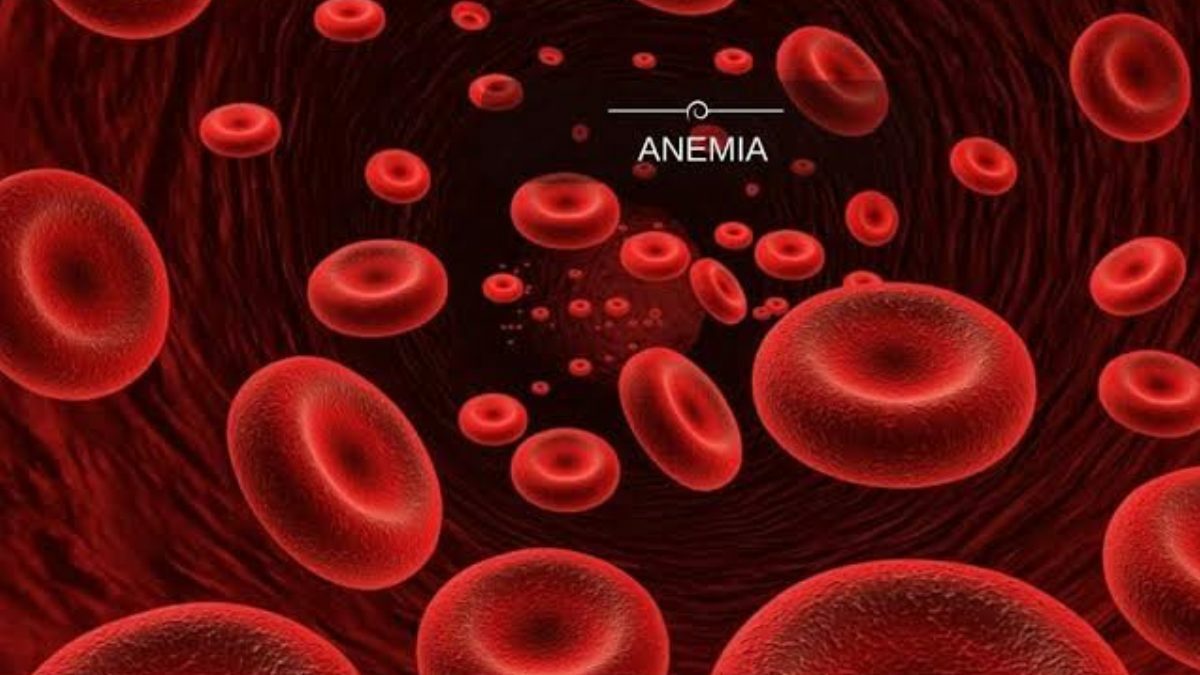 66 percent women in Jammu and Kashmir Anaemic: Report