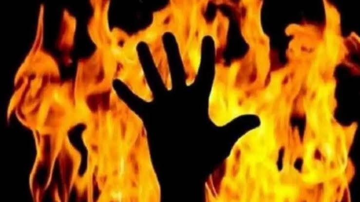 Teenage girl from Bemina succumbs to burn injuries at SMHS hospital