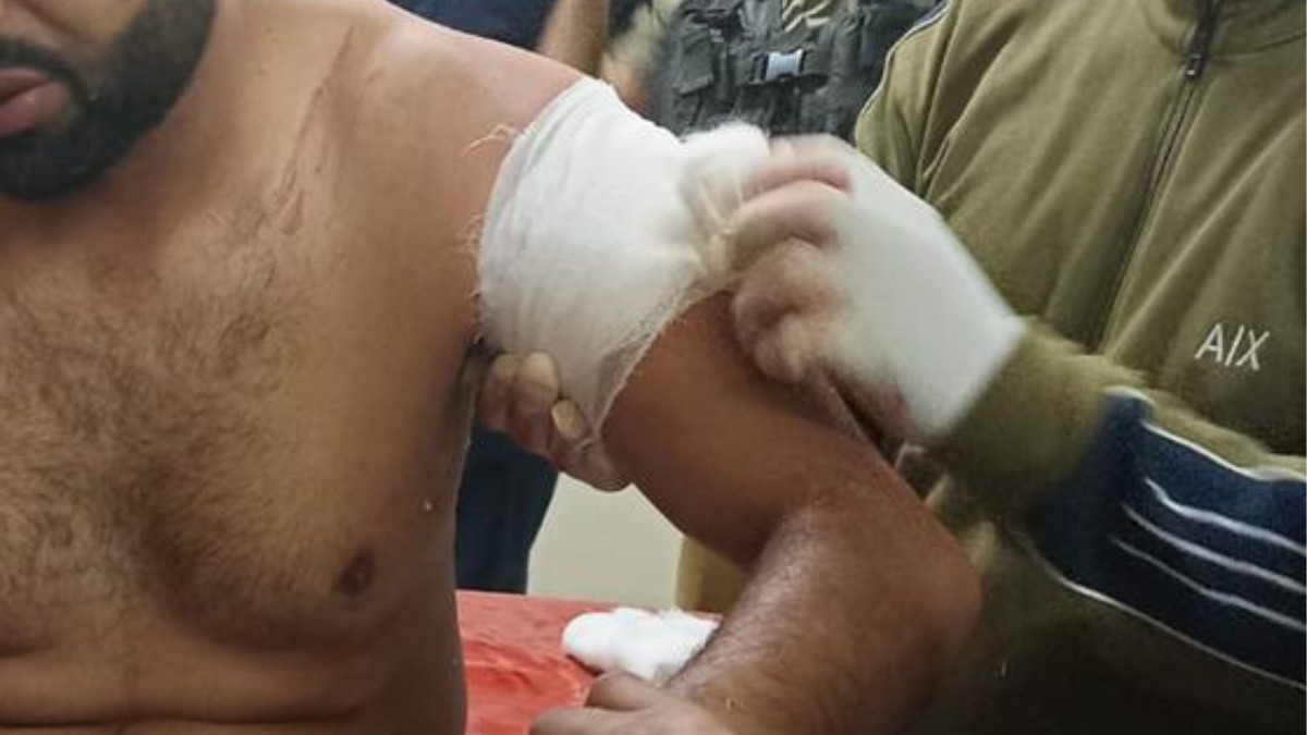 Civilian shot at, injured in Marhama, Bijbehara Civilian shot at, injured in Marhama, Bijbehara