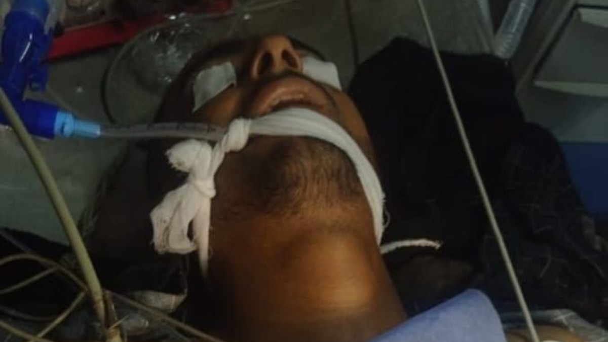 Unknown gunmen fire at two forest deptt employees in Pulwama