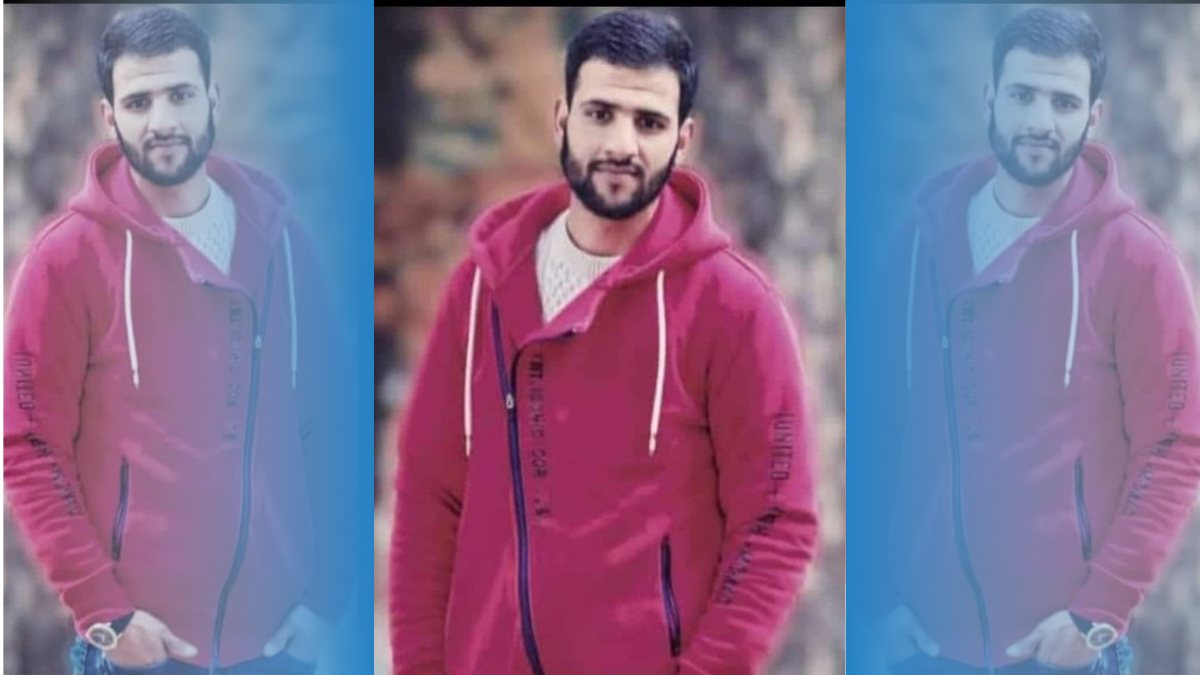 Painter injured in thinner explosion in Budgam succumbs