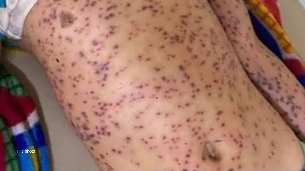 Man dies after being attacked by bees, another injured