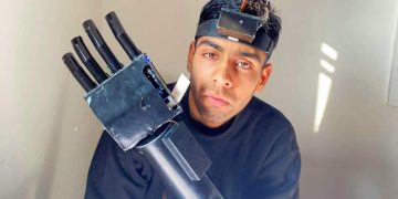 Srinagar teen develops robotic arm controlled by head movements