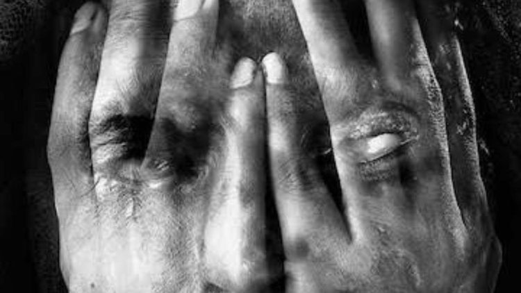 Woman throws acid on man for refusing to marry her; arrested